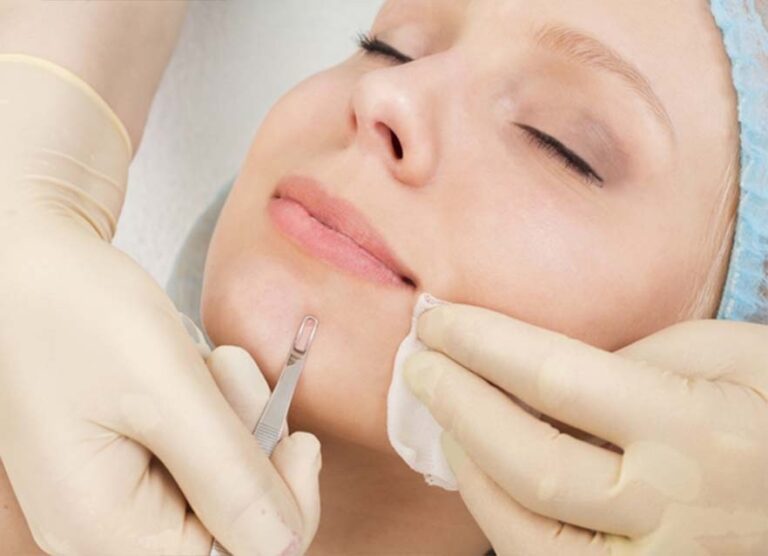 limpieza facial