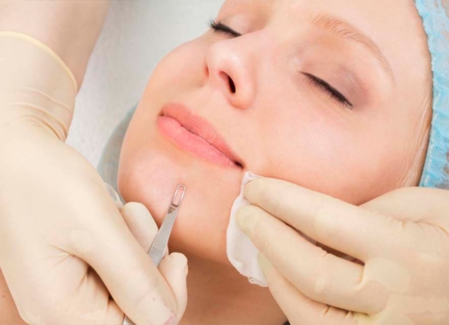 limpieza facial